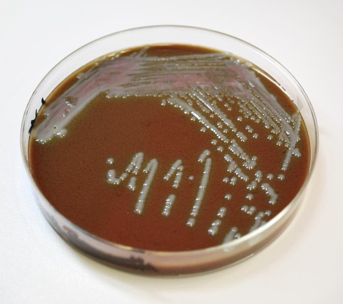 Chocolate_agar_1.jpg